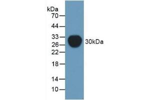 Detection of Recombinant Pgp, Mouse using Polyclonal Antibody to Permeability Glycoprotein (Pgp) (Permeability Glycoprotein antibody  (AA 391-627))