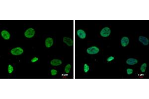 Immunofluorescence (IF) image for anti-RecQ Protein-Like (DNA Helicase Q1-Like) (RECQL) (C-Term) antibody (ABIN2857057)