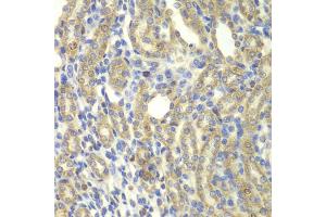 Immunohistochemistry of paraffin-embedded rat kidney using KBTBD7 antibody (ABIN5975133) at dilution of 1/100 (40x lens). (KBTBD7 antibody)