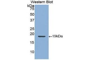 Western Blotting (WB) image for anti-Keratin 9 (KRT9) (AA 315-456) antibody (ABIN3208415)
