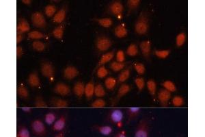 Immunofluorescence analysis of HeLa cells using CDK11B Polyclonal Antibody at dilution of 1:100. (CDK11 antibody)