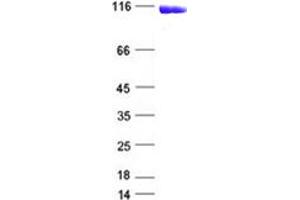 Western Blotting (WB) image for Poly (ADP-Ribose) Polymerase 1 (PARP1) protein (DYKDDDDK Tag) (ABIN2728265)