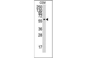 Western blot analysis of anti-YARS Antibody (C-term) in CEM cell line lysates (35ug/lane). (YARS antibody  (C-Term))