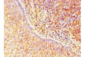 Immunohistochemistry of paraffin-embedded human tonsil tissue using ABIN7172265 at dilution of 1:100 (TLR1 antibody  (AA 20-270))