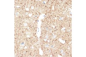 Immunohistochemistry of paraffin-embedded human brain using V Rabbit mAb (ABIN7271312) at dilution of 1:100 (40x lens). (VAMP1 antibody)