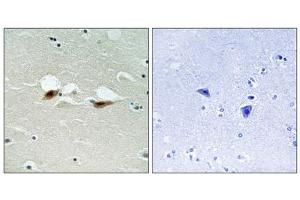 Immunohistochemistry analysis of paraffin-embedded human brain tissue using ATF2 (Phospho-Ser472) antibody. (ATF2 antibody  (pSer472))
