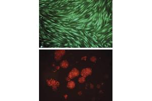Anoikis of Human Fibroblast BJ-TERT Cells. (CytoSelect™ 24-well Anoikis Assay (Colorimetric/Fluorometric))