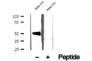 Western blot analysis of extracts of NIH/3T3 cells, using CREST antibody. (SS18L1 antibody)