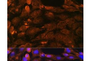 Immunofluorescence analysis of C6 cells using PTCH1 Polyclonal Antibody at dilution of 1:100. (Patched 1 antibody)