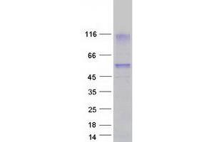 Validation with Western Blot