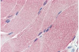 Human Skeletal Muscle (formalin-fixed, paraffin-embedded) stained with THBS1 antibody ABIN337292 at 10 ug/ml followed by biotinylated anti-mouse IgG secondary antibody ABIN481714, alkaline phosphatase-streptavidin and chromogen. (Thrombospondin 1 antibody  (Collagen-binding Domain))