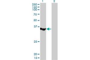 Western Blot analysis of MTMR1 expression in transfected 293T cell line by MTMR1 monoclonal antibody (M01), clone 1F10. (MTMR1 antibody  (AA 39-112))