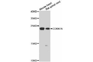 Western blot analysis of extracts of various cell lines, using CDKN1A antibody (ABIN5970693) at 1/1000 dilution.