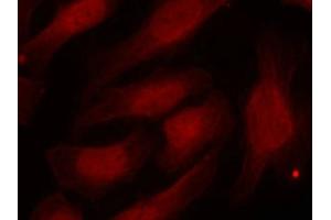 Immunofluorescence staining of methanol-fixed Hela cells using Histone H2A. (H2AFX antibody  (pSer139))