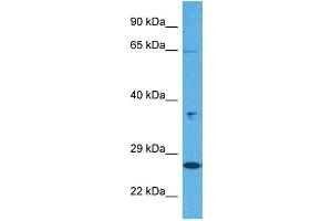 Host:  Rabbit  Target Name:  KL  Sample Tissue:  Human Jurkat Whole Cell  Antibody Dilution:  1ug/ml (Klotho antibody  (N-Term))