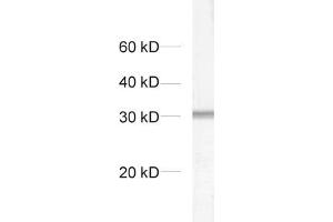 dilution: 1 : 1000, sample: crude synaptosomal fraction of rat brain (P2) (Syntaxin 6 antibody  (AA 1-235))