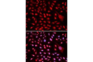 Immunofluorescence (IF) image for anti-Core-Binding Factor, beta Subunit (CBFB) (AA 1-182) antibody (ABIN6138000)