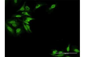 Immunofluorescence of purified MaxPab antibody to EPB41L2 on HeLa cell. (EPB41L2 antibody  (AA 1-633))