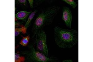Image no. 3 for anti-Mdm2, p53 E3 Ubiquitin Protein Ligase Homolog (Mouse) (MDM2) (pSer166) antibody (ABIN401611) (MDM2 antibody  (pSer166))