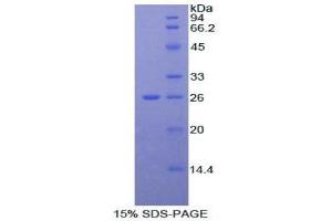 SDS-PAGE analysis of Mouse alpha Fodrin Protein. (SPTAN1 Protein)