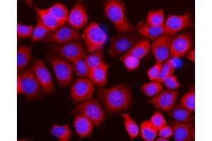 IF analysis of RPL10 using anti-RPL10 antibody (ABIN7601177). (RPL10 antibody  (AA 3-214))