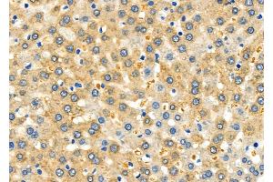 ABIN6264773 and ABIN6278630 at 1/100 staining Rat liver tissue by IHC-P. (URI1 antibody  (Internal Region))