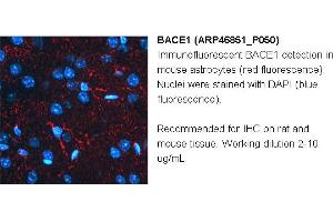 Image no. 3 for anti-Beta-secretase 1 (BACE1) (N-Term) antibody (ABIN2782766) (BACE1 antibody  (N-Term))