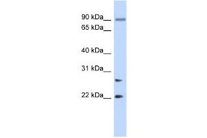 JOSD2 antibody used at 1 ug/ml to detect target protein. (JOSD2 antibody  (N-Term))