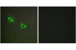 Immunofluorescence analysis of A549 cells, using Cytochrome P450 2S1 Antibody. (CYP2S1 antibody  (AA 181-230))