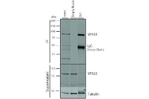 Immunoprecipitation analysis using Mouse Anti-VPS35 Monoclonal Antibody, Clone 7E4 (ABIN6932927).