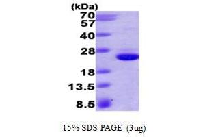 SDS-PAGE (SDS) image for HRas proto-oncogene, GTPase (HRAS) (AA 1-186) protein (His tag) (ABIN666969) (HRAS Protein (AA 1-186) (His tag))