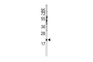 Western blot analysis of anti-SNRPC Antibody (C-term) (ABIN389354 and ABIN2839460) in K562 cell line lysates (35 μg/lane). (SNRPC antibody  (C-Term))