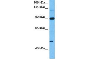 Western Blotting (WB) image for anti-Hypoxia Inducible Factor 1, alpha Subunit (Basic Helix-Loop-Helix Transcription Factor) (HIF1A) (Middle Region) antibody (ABIN2780373)