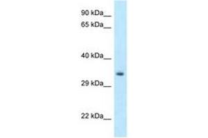 Image no. 1 for anti-Homeobox C11 (HOXC11) (C-Term) antibody (ABIN6747866) (HOXC11 antibody  (C-Term))