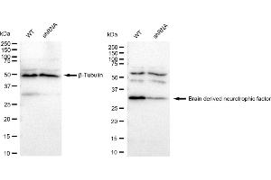 Western blotting analysis using Brain derived neurotrophic factor antibody (ABIN7797780).