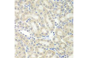 Immunohistochemistry of paraffin-embedded mouse kidney using PRDX5 antibody (ABIN5973743) at dilution of 1/200 (40x lens). (Peroxiredoxin 5 antibody)