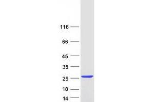 Western Blotting (WB) image for Adenine Phosphoribosyltransferase (APRT) (Transcript Variant 1) protein (Myc-DYKDDDDK Tag) (ABIN2714849)