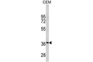 Western blot analysis of MPZ Antibody (C-term) in CEM cell line lysates (35ug/lane). (MPZ antibody  (C-Term))