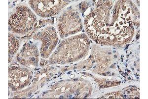 Immunohistochemical staining of paraffin-embedded Human Kidney tissue using anti-TUBAL3 mouse monoclonal antibody. (TUBAL3 antibody  (AA 150-446))