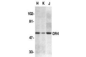 Western Blotting (WB) image for anti-Tumor Necrosis Factor Receptor Superfamily, Member 10a (TNFRSF10A) (N-Term) antibody (ABIN2479548) (TNFRSF10A antibody  (N-Term))