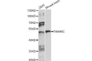 Western blot analysis of extracts of various cell lines, using FAM46C antibody (ABIN6292917) at 1:1000 dilution. (FAM46C antibody)