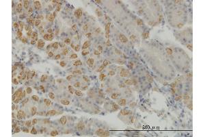 Immunoperoxidase of monoclonal antibody to AATK on formalin-fixed paraffin-embedded human stomach. (AATK antibody  (AA 161-260))