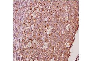 Immunohistochemistry analyzes of AP20378PU-N Ephrin-A1 antibody in paraffin-embedded human tonsil carcinoma tissue at 1/50. (Ephrin A1 antibody)