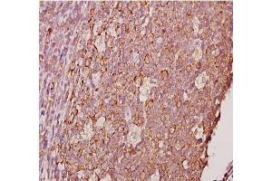 Immunohistochemistry analyzes of AP20378PU-N Ephrin-A1 antibody in paraffin-embedded human tonsil carcinoma tissue at 1/50.