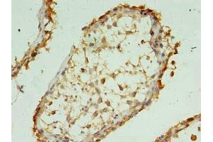 Immunohistochemistry of paraffin-embedded human testis tissue using ABIN7175875 at dilution of 1:100 (XAGE1 antibody  (AA 1-81))