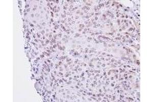 Immunohistochemistry: Lamin B2 antinbody staining of Paraffin-Embedded Cal27 Xenograft at 1/100 dilution.