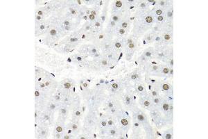 Immunohistochemistry of paraffin-embedded mouse liver using HNRNPR antibody (ABIN5975822) at dilution of 1/100 (40x lens). (HNRNPR antibody)