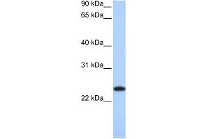 WB Suggested Anti-FTL Antibody Titration: 0. (FTL antibody  (Middle Region))