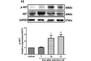 The CXCR7 and PI3K/Akt signaling pathways are involved in CPSP in the dorsal horn of the spinal cord. (GAPDH antibody)