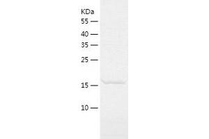 CETN3 Protein (AA 1-167) (His tag)